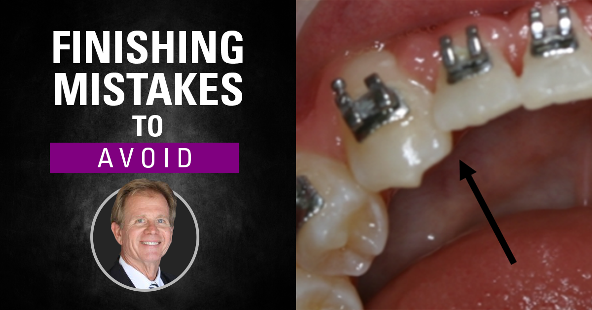 Top Orthodontic Finishing Mistakes to Avoid A Guide by Dr. Jeffery Taylor